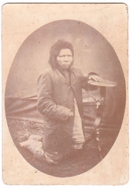 Indian Missing Hand and Feet