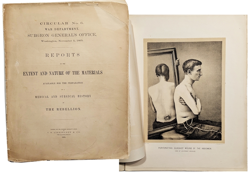 1865 Medical Report Replete With Illustrations